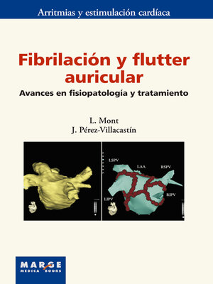 cover image of Fibrilación y flutter auricular